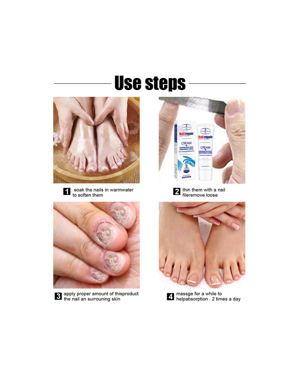 Crema Reparadora de Uñas Antihongo – Tratamiento Regenerador para Uñas Dañadas