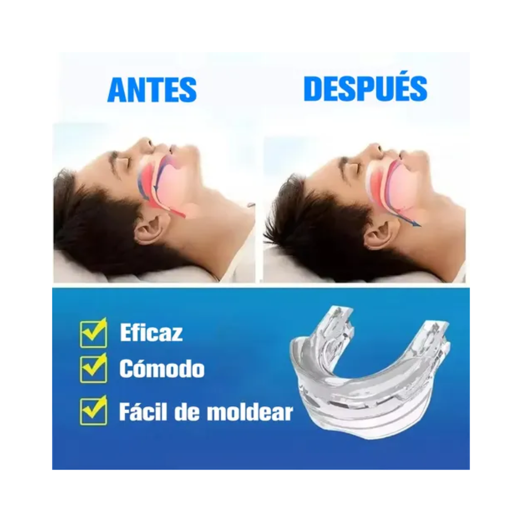Protección Dental Antirronquidos – Dispositivo Bucal para Reducir Ronquidos al Dormir