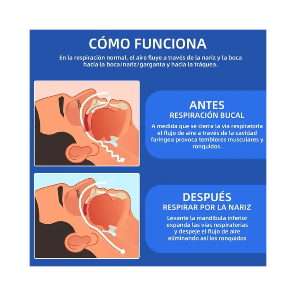 Protección Dental Antirronquidos – Dispositivo Bucal para Reducir Ronquidos al Dormir